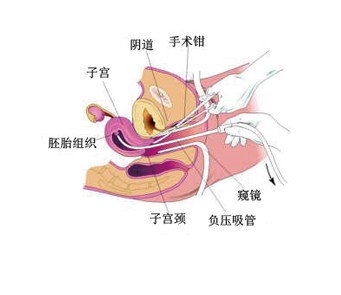 药流有什么副作用(图1)